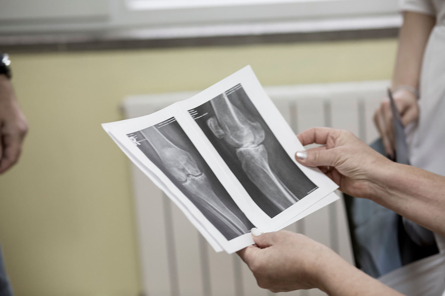 Ревматологія Івано-Франківськ